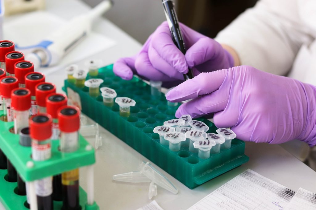 laboratory researcher labels test tubes