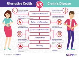 Ulcerative Colitis vs Crohn's Disease infographic
