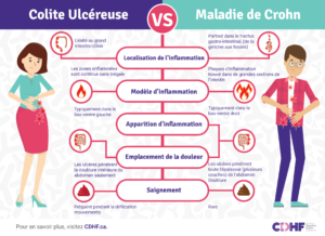 Différences entre la maladie de Crohn et la colite ulcéreuse