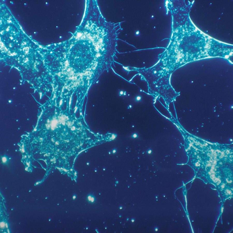 human connective tisse at 500x magnification human connective tisse at 500x magnification